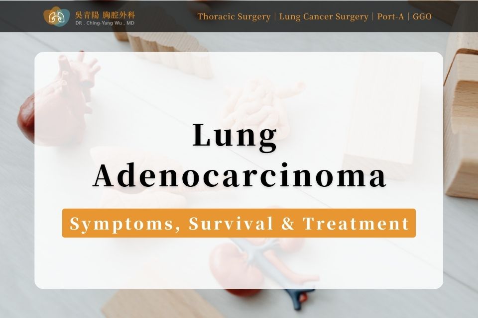 Lung Adenocarcinoma Symptoms and Early Warning Signs at a Glance: A Complete Overview of Survival Rates, Screening, and Treatment